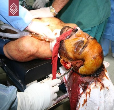 ������ 2