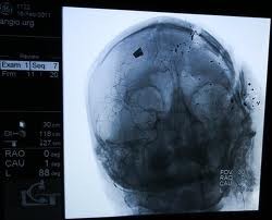 ��� ����� �� ����