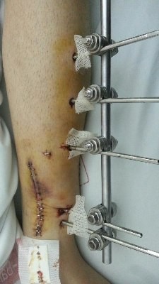 ���� ����