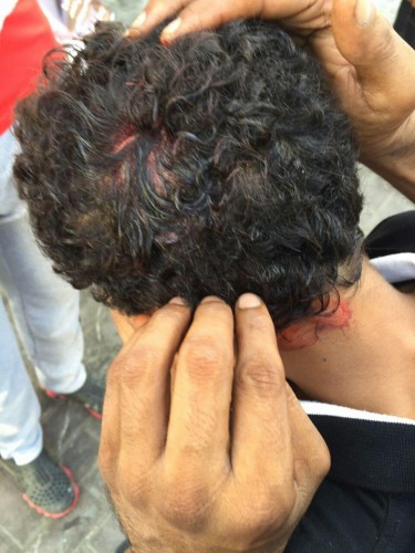 �������3