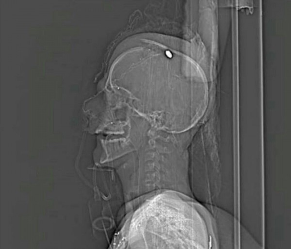 ����� �����